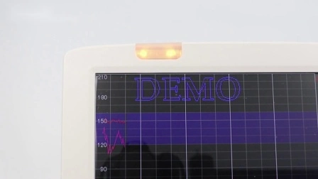 Baby-Herzmonitor mit EKG, SpO2, Resp, NIBP/Fetalmonitor mit 12,1-Zoll-Bildschirm